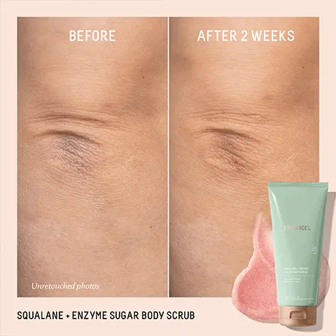 Image 1, BEFORE AFTER 2 WEEKS Unretouched photos SQUALANE + ENZYME SUGAR BODY SCRUB BIOSSANCER Image 2, BIOSSANCE SQUALANE ENZYME SUGAR BODY SCRUB IMMEDIATELY Panelists showed +101% improvement in skin hydration' AFTER 2 WEEKS 100% agree the product reduced the appearance of bumpy skin, uneven texture, and flakiness2 100% agree the product rinsed clean without a greasy residue2 Based on a clinical study of 37 women ages 18-50, ofter immediate use *Based on a 14-day consumer study of 37 women, ages 18-50 Image 3, LET'S BREAK IT DOWN PHYSICAL EXFOLIATION Sugar crystals gently buff and polish dead cells from the skin's outermost layer ENZYMATIC EXFOLIATION Pomegranate enzymes break down and dissolve dead skin cells Image 4, SUGAR CRYSTALS A natural exfoliant that dissolves in BIOSSANCE. water to prevent over-exfoliation SUGARCANE- DERIVED SQUALANE A lightweight moisturizing oil that minimizes irritation when exfoliating SQUALANE ENZYME SUGAR BODY SCRU POMEGRANATE ENZYMES Effectively breaks down and removes dead skin cells gently and more rapidly than AHAS Image 5, YOUR HYDRATING BODYCARE ROUTINE BANCE BODY CREA BIOSSANC SOCALARE-ENDING BIOSSANCE 100% SQUALANE OIL Step 1: Exfoliate SQUALANE + ENZYME SUGAR BODY SCRUB Tip: For a stronger scrub, use less water. Step 2: Moisturize SQUALANE + CAFFEINE TONING BODY CREAM Tip: Mix with 100% SQUALANE OIL for a hydration boost.