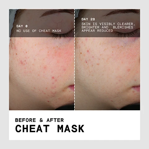 Image 1 - Split image showing before and after results on a persons face after using a product, with text Day 0 No Use Of Cheat Mask, Day 28 Skin Is Visibly Clearer, Brighter And Blemishes Appear Reduced, and Before & After Cheat Mask. Image 2 - A split image shows a persons face before and after using a mask, with the skin appearing clearer and less red after 7 days, with text reading DAY 0 NO USE OF CHEAT MASK DAY 7 SKIN IS VISIBLY CLEARER REDNESS AND BLEMISHES APPEAR REDUCED BEFORE & AFTER CHEAT MASK. Image 3 - A split image shows a persons cheek before and after using a product, with text overlay reading DAY 0 NO USE OF CHEAT MASK and DAY 28 SKIN IS VISIBLY CLEARER, SCARRING AND REDNESS APPEARS REDUCED, and text below reading BEFORE & AFTER CHEAT MASK.