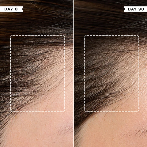 Image 1 - A side-by-side comparison shows a persons hairline with sparser hair on the left and visibly thicker, denser hair on the right, labelled Day 0 and Day 90. Image 2 - A dark green bottle of Philip Kingsley Density Preserving Scalp Drops with a white dropper and clear liquid spheres, next to text listing Key Benefits: Stimulates and protects follicles to preserve hair density, Creates an optimal scalp environment for healthy hair growth, and Helps reduce hair fall and preserve the hair you have, with the bottle label also showing SÉRUM PROTECTEUR POUR CUIR CHEVELU, Reduces hair fall and preserves density, Réduit la chute du cheveu et préserve sa densité capillaire, 80ml, 2.87 fl oz. Image 3 - A close-up of a persons dark hair and scalp shows a clear dropper applying liquid to the hair parting, with text that reads CLINICALLY PROVEN to slow hair loss and reduce shedding after 3 months use*. *INDEPENDENT CLINICAL TRIALS BASED ON A MINIMUM OF 3 MONTHS DAILY. Image 4 - A green and white Philip Kingsley Density Thickening Shampoo tube with suds is depicted, accompanied by the text Increased hair VOLUME by 14% AFTER ONE USE and Volumises and strengthens fine, fragile hair, with a footnote explaining INDEPENDENT INSTRUMENTAL TESTS OF DENSITY SHAMPOO & CONDITIONER, COMPARED TO A STANDARD SHAMPOO AND CONDITIONER. Image 5 - A hand holds a dark green and white tube of Philip Kingsley Density Thickening Conditioner, 175ml 5.9 fl oz, next to a list of KEY BENEFITS stating: Instantly volumises fine, fragile hair, Improves hairs resistance against future damage, and Thickens hair. Image 6 - A person squeezes a dark green and white tube of Philip Kingsley Density Stimulating Conditioner, dispensing white cream into their palm, next to text that reads: It has RESTORED my very thinning hair back into my THICKER HAIR that I am used to!* USER TRIAL PANEL COMMENT. Image 7 - The image shows four dark green Philip Kingsley Density hair care products arranged diagonally, illustrating a four-step routine, with visible text DENSITY: FOR FULLER, THICKER HAIR, Step 1 Cleanse Philip Kingsley Density Thickening Shampoo, Step 2 Condition Philip Kingsley Density Thickening Conditioner, Step 3 Preserve Philip Kingsley Density Preserving Scalp Drops, and Step 4 Protect Philip Kingsley Density Thickening Protein Spray.