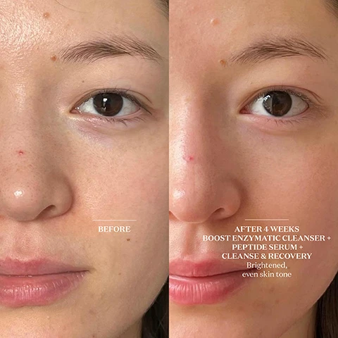 image 1, before and after 4 weeks of boost enzymatic cleanser, peptide serum, cleanse and recovery - brightened and even skin tone. image 2, boost enzymatic cleanser and mask. scientifically formulated to optimise LED absoption. do i need to use a specific cleanser with LED? no, but it helps. through years of delivering LED in professional facials, our co founder laura fergusn discovered that the smoother and more hydrated the skin's barrier, the better it absorbs light. this led her to create our skin smoothing enzymatic cleanser and mask. image 3, boost enzymatic cleanser and mask formulation notes - laura ferguson said = through years of delivering LED in professional facials, i discovered that the smoother and more hydrated the skin, the better it absorbs light. this formula exfoliates and hydrates, priming the skin for optimal light absorption.