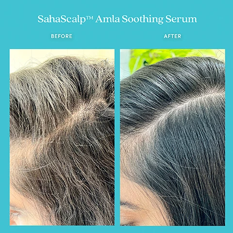 Image 1, sahascalp amla soothing serum before and after. image 2, sahascalp wild ginger purifying scrub before and after. image 3, saha scalp cooling scalp mud mask before and after. image 4, the saha scalp rital. cruelty free, vegan formula, no silicones, all hair types.