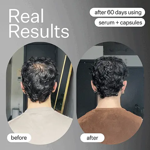 Image 1, What to expect, 1-2 uses, supports optimal environment for hair growth, 3-4 uses, less hair fall out, thicker looking hair, 5-6 uses, new baby hair and hair growth appears faster Image 2, Real Results before and after one use, image shows thicker, fuller hair after use. Image 4, 91% agreed scalp felt nourished, 89% agreed scalp felt and looked healthier, 89% agreed overall hair health improved, proven results, results from a consumer perception study with all hair and scalp types. Image 5, Stem Cell Serum Ingredients: Swiss Apple Stem Cells (2%) Clinically-proven to support optimal environment for hair growth. Protects against thinning and shedding. Bamboo and Pea Sprout Blend (2%) Supports hair follicle condition. Protects from free radical damage responsible for the premature ageing of hair follicle. Aloe Vera (1%) Soothes the scalp and helps prevent scalp imbalances. Production: 100% Ethical Labor, Manufacturing Method Cold Processed, Packaging: Bottle Glass, Pipette PET Plastic, Recyclability 85%, Box Material Certified Post Recycled Image 6, 5 stars, my scalp has never felt better, 500k 5 star reviews Image 7, loved by goop, forbes, coveteur, elite daily, byrdie. Image 8, Best Seller, Shop Scalp, pre-cleanse oil to break down buildup, gentle scalp exfoliator with salycilic acid, hydrating growth serum