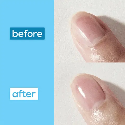 Image 1, before and after model shot. Image 2,essie strengtheners. Neutralize and brighten, advanced and glow and shine. Colour: Sheer violet tint, clear tint and sheer pink tint. Results: neutralizes yellow undertones, strengthens and hydrates damaged nails and provides a natural glow. Image 3, for best results wear for 3 days before removal. Image 4, clinically tested formula. Image 5, High performing nail care essentials hydrate and repair with: 1. hard to resist advanced 2. apricot cuticle oil