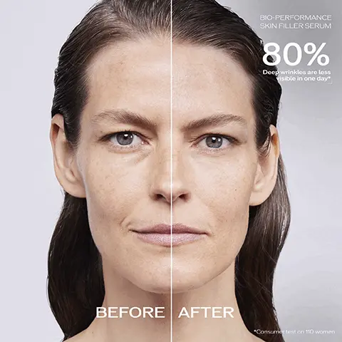Image 1, bio performance skin filler serum 80% deep wrinkles are less visible in one day before and after model shot. Image 2, refill your 2 serums 74% plastic waste reduced, 20% plant derived bottle