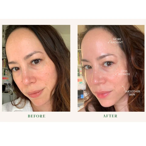 before and after, more radiant, less redness and smoother skin