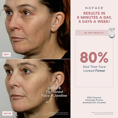 Image 1- results in 5 minutes a day, 5 days a week. day 1 vs day 60 lifted and tightened face and jawlines. unretouched clinical results taken in standard lighting individual results may vary. 60 day results, 80% said their face looked firmer. FDA cleared, clinically proven, aesthetician created. results from post treatment consumer questionnaire after 60 days of use. image 2, 1 device, results anytime, anywhere. 3 intensity levels, auto shut off at 5 minutes. tone, lift and contour down to the muscle. petite and portable. 5 second beep. includes charging cable. FDA cleared, clinically proven, aesthetician created. image 3, 1 device, results anytime, anywhere. smooth the neck, contour the cheeks, lift the brow. image 4, day 1 vs day 60 smoother skin. unretouched clinical results taken in standard lighting individual results may vary. 60 day results, 80% said saw smoother skin. FDA cleared, clinically proven, aesthetician created. results from post treatment consumer questionnaire after 60 days of use. image 4, day 1 vs day 60. unretouched clinical results taken in standard lighting individual results may vary. 60 day results, 82% said their face looked more toned. 80% said their face looked firmer. 78% saw smoother skin. FDA cleared, clinically proven, aesthetician created. results from post treatment consumer questionnaire after 60 days of use. image 5, lift brows, contour cheeks, contour jawlines, tighten neck.nimage 6, 1 device, results anytime. anywhere. instant results that build with consistent use. tone - jowls and jawlines. lift = brows. contour - cheeks. smooth - neck and forehead. image 6, 1 device customisable results. instant results that build with consistent use contour = cheeks. lift = eyes and brows. tone = jowls and jawline. smooth = neck and forehead. lift = lips and smile lines. image 8, trinity = customised lifting. depth - to the muscle. intensity levels - 5. attachment options - eye an lip attachment and LED red light attachment sold separately - yes. micro current treatment areas - jowls and jawlines, neck, cheeks and forehead, around eyes and brows, around mouth and lips, smile lines. mini on the go-lifting = depth of treatment - to the muscle. intensity levels - 3. microcurrent treatment areas - jowls and jawline, neck and cheeks and forehead. fix instant finisher = depth of treatment - skin's surface. intensity levels - 1. microcurrent treatment areas - around eyes and brows, around mouth and lips, smile lines