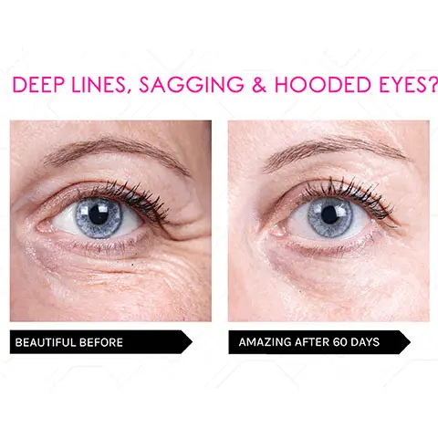 Image 1, Text- Deep lines, sagging and hooded eyes? Beautiful before- Amazing after 60 days. Before and after images show how deep lines appear smoother and the eye looks lifted after using the product for 60 days. Image 2, Text- Dull and dehydrated under eyes? Beautiful before- Amazing after 21 days. Before and after images show how the under eye appears smoother and brighter after using the product for 21 days 