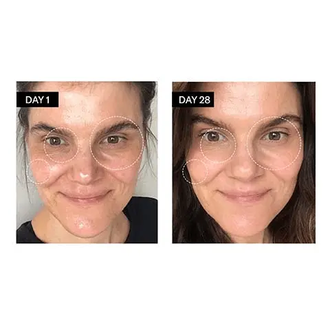 Image 1 and 2, before and after. Image 3, 78& agree skin looks healthier after using this product. 82% agree this serum restored a more luminous glow