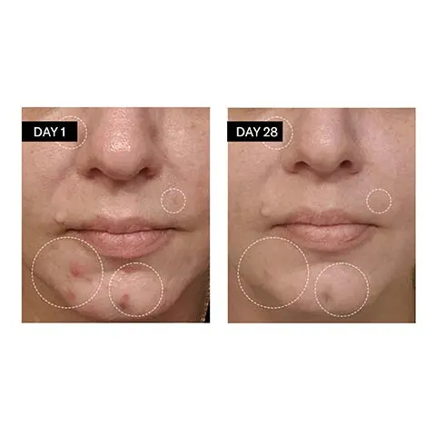Image 1-3, before and after. Image 4, 78% reduction in the appearance of skin imperfections. 80% agree this serum improves general appearance of skin