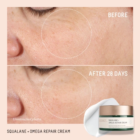 squalane plus omega repair cream. before and after 28 days. unretocuhed photos