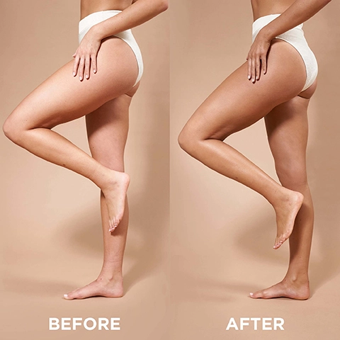 Before. After.