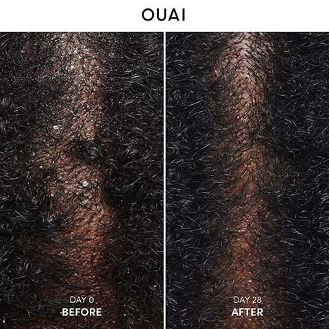 Image 1 - A split image shows a scalp with dark, curly hair, with the left side depicting visible dandruff flakes and the text DAY 0 BEFORE, and the right side showing a significantly cleaner scalp with fewer to no flakes and the text DAY 28 AFTER, all beneath the OUAI logo. Image 2 - A before and after comparison of a scalp with dark hair, showing significant dandruff on the left labeled DAY 0 BEFORE, and a much clearer scalp with minimal dandruff on the right labeled DAY 28 AFTER, with the brand name OUAI at the top. Image 3 - A light green Ouai Anti-Dandruff Shampoo bottle with a white cap is on a blue surface, featuring text OUAI, ANTI-DANDRUFF SHAMPOO, SHAMPOOING ANTIPELLICULAIRE, 10 fl oz / 300 ml, and additional call-out text reading Helps reduce the appearance of flaking, Soothes and relieves dry scalp from flaking, itching, redness and irritation, and Helps reduce appearance of itching, redness, and irritation associated with dandruff. Image 4 - An image featuring a comparison table of OUAI Detox Shampoo (orange bottle) and OUAI Anti-Dandruff Shampoo (light green bottle) with the heading FEATURE. The table details: Helps reduce appearance of flaking (both shampoos), Helps reduce appearance of itching, redness, and irritation associated with dandruff (Anti-Dandruff Shampoo), Helps remove heavy metals, minerals, and chlorine found in hard water (Detox Shampoo), Soothes and relieves dry scalp from flaking, itching, redness and irritation (Anti-Dandruff Shampoo). Usage for Detox Shampoo is When you need a deeper cleanse, and for Anti-Dandruff Shampoo is 2x a week or as directed by doctor. Below the table, the text reads: Both DETOX SHAMPOO & ANTI-DANDRUFF SHAMPOO are gentle enough for all hair types and textures and both are: CRUELTY FREE, SUSTAINABLE PACAKAGING, COLOR SAFE, KERATIN SAFE, SULFATE FREE, PARABEN FREE.