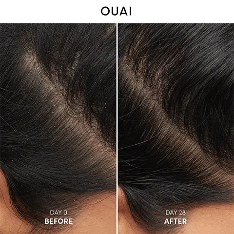 Image 1 & 2, OUAI, before and after image, Day 0 vs Day 28