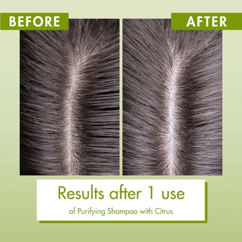 before and after, results after 1 use of purifying shampoo with citrus