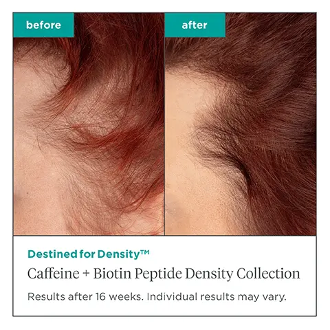 Image 1, before and after, destined for density, caffeine and biotin peptide density collection, resultd after 16 weeks, individual results may vary. Image 2, destined for density collection. up to 3.5 times more visible volume, 96% noticed less hair fallout and shedding after using the four piece regimen**. *compared to baseline in a 16-week study of 29 participants. **compared to baseline in a 29 participant consumer perception study after 16 weeks of daily use. Image 3, nourish from the inside out for fuller, thicker and healthier looking hair.