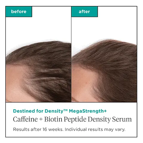 Image 1 - 3, before and after, destined for density megas trength caffeine plus biotin peptide density serum. results after 16 weeks, individual results may vary. Image 4, destined for density, up to 31% more follicle activity with daily use. 94% noticed increased thickness in areas of concern. *compared to baseline in a 16-week study of 35 participants. **compared to baseline in a 35 participant consumer perception after 16 weeks of daily use. Image 5, destine for density collection. up to 3.5 times more visible volume. 96% noticed less hair fallout and shedding after using the four piece regimen. *compared to baseline in a 16-week study of 29 participants. **compared to baseline in a 29 participant consumer perception study after 16 weeks of daily use. Image 6, promotes hair density, weihtless fast -absorbing formula, unique density boosting complex. Image 7, caffeine plus biotin peptide density serum, out breakthrough microfluidic technology means faster absorption of our nutrient rich leave in serum, leaving hair looking and feeling clean and non greasy. Image 8, lightweight formula absorbs quickly on the scalp. Image 9, nourish from the inside out for fuller, thicker and healthier looking hair.