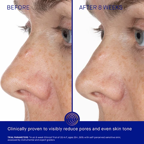 Image 1 - Side-by-side comparison of skin texture on a nose and cheek labeled BEFORE and AFTER 8 WEEKS, with text Clinically proven to visibly reduce pores and even skin tone TRIAL PARAMETERS *in an 8-week Clinical Trial of 35 m/f, ages 35+, 50% with self-perceived sensitive skin; assessed by instrumental and expert graders.
Image 2 - A blue tube of Augustinus Bader Foaming Cleanser surrounded by foam is shown next to text reading Clinically Proven Results Uneven pigmentation improved by 63% Skin texture improved by 57% 100% of participants showed a reduction in excess oil AB Augustinus Bader THE FOAMING CLEANSER WITH TFC8® LE DÉMAQUILLANT MOUSSANT AVEC TFC8® 100 ml e *In an 8-week Clinical Trial of 31 m/f, ages 18-70, 50% with self-perceived sensitive skin; assessed by instrumental and expert graders.
Image 3 - A blue tube of Augustinus Bader The Foaming Cleanser partially submerged in water next to text that reads User Proven Results 95% agree excess oil is reduced without drying 95% agree skin looked brighter and more radiant 98% agree pores appeared decongested and skin clearer *In an 8-week Consumer Perception Study of 109 m/f, ages 18-70, 50% with self-perceived sensitive skin.
Image 4 - A blue Augustinus Bader foaming cleanser tube with a copper cap and white foam is surrounded by ingredient details including AB Augustinus Bader THE FOAMING CLEANSER WITH TFC8® LE DEMAQUILLANT MOUSSANT AVEC TFC8® 100 ml e 3.38 fl. oz. TFC8® A proprietary complex that creates the optimal environment to support skin cellular renewal VITAMIN C Helps to support the natural collagen production and even skin NIACINAMIDE Helps improve skin tone and elasticity LANGSAT LEAF EXTRACT Illuminates and evens skin tone.
Image 5 - Image shows three skincare products, The Cream Cleansing Gel Texture Lightweight gel cleanser Key Benefits Soothing & Hydrating Key Concerns Dryness irritation redness pores uneven texture Ideal For All skin types dry or irritated skin, The Foaming Cleanser Texture Cream-to-foam cleanser Key Benefits Illuminating & Balancing Key Concerns Oil pores uneven tone makeup removal Ideal For Normal to oily skin types blemish-prone skin, and The Cleansing Balm Texture Balm-to-oil cleanser Key Benefits Nourishing & Calming Key Concerns Dryness irritation redness stubborn makeup Ideal For Normal to very dry skin.
Image 6 - A three-step skincare routine is shown with images of applying product, lathering the face, and rinsing, accompanied by the text Step 1 Apply a dime-sized amount to damp skin Step 2 Gently massage in circular motions to create a rich lather Step 3 Rinse thoroughly and follow with your Augustinus Bader skincare routine.