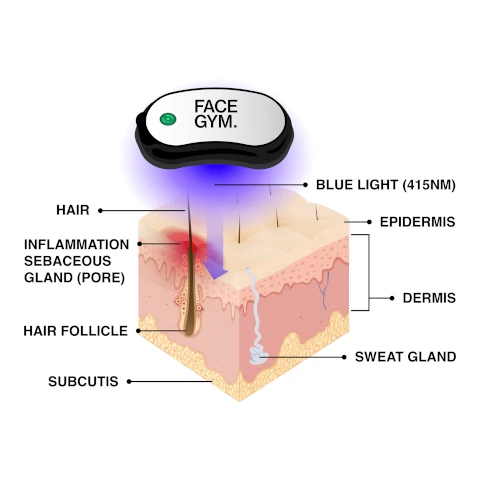 diagram of how blue light works. haur, inflammation sebaceous gland (pore), hair follicle, subcutis, blue light (415NM) epidermis, dermis, sweat gland.