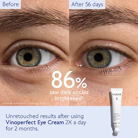 Image 1, before and after 56 days. 86% saw dark circles brightened. unretouched results after using vino perfect eye cream 2 times a day for 2 months. image 2, corrects all types of dark circles. 86% saw dark circles brightened. image 3, niacinamide = evens the eye contour. viniferine = 62 times more effective than vitamin c, corrects dark and brown dark circles. caffeine = corrects blue/purple dark circles. image 4, brightening micropeel foam, brightening glycolic essence, brightening dark spot serum, brightening eye cream, instant brightening moisturiser, glycolic night cream.