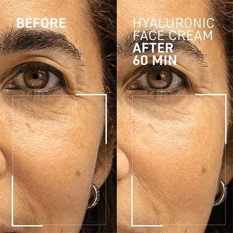before, hyaluronic face cream after 60min. 100% reported hydrated and replenished skin for up to 72 hours, 97% reported a reduction of wrinkles and expression lines. Instrumental evaluation on 31 volunteers. Instrumental evaluation by image analysis conducted on 38 volunteers 4 weeks of use around the mouth area. Fill in the lines, intense hydration deep into skin, plumps the skin filling out the fine lines and wrinkles, helps restore definition to facial contours. Hydropeptides optimise the efficacy of hyaluronic acids in skin, HA4 four types of hyaluronic acid to replenish water and hydrate. Natural origin ingredients 97%, paraben free, sulfate free, synthetic fragrance free, vegan, GMO free, cruelty free. Step 4 moisturize. 1. cleanse, 2. exfoliate, 3. treat, 4. moisturize, 5. protect. How - apply after your serum. When - Daily. AM AND PM.