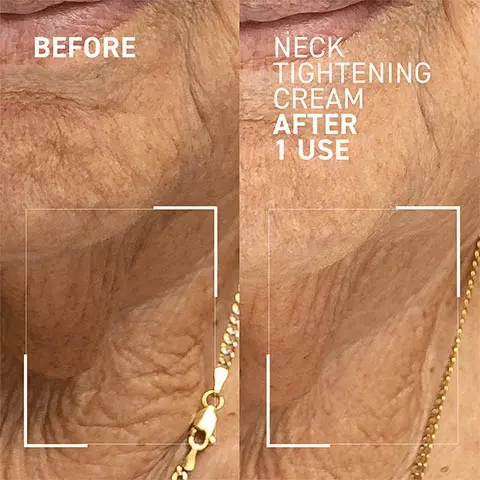 before, neck tightening cream after 1 use. 94% reported a firmer neck, 91% reported an improvement in skin elasticity, self assessment evaluation conducted on 34 volunteers after 4 weeks, instrumental evaluation conducted on 34 volunteers after 8 weeks. Reveal your neck not your age. Tightens and lifts the look of sagging neck skin, smooths the appearance of creases, improves sagging under the chin. Glycolic acid refines skin texture, firming-peptides boost collagen production and quality, polysaccharides activates skin mechanobiology to tighten fibres. Natural origin ingredients 95%, paraben free, sulfate free, synthetic fragrance free, vegan, GMO free, cruelty free. Step 4 moisturize. 1. cleanse, 2. exfoliate, 3. treat, 4. moisturize, 5. protect. How - apply on cleansed skin from collarbone to jawline in an upward motion. When - Daily. AM AND PM.