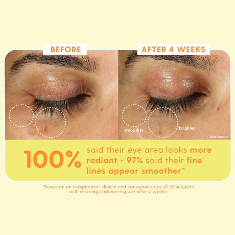 before and after 4 weeks. 100% said their eye area looks more radiant and 97% said their fine lines appear smoother. *based on an independent clinical and consumer study of 35 subjects with morning and evening use after 4 weeks.