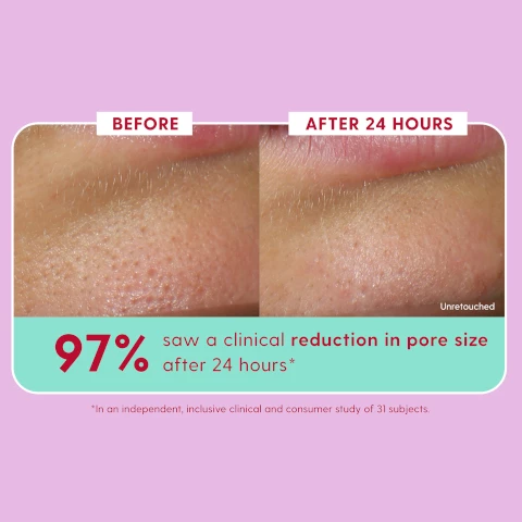 Image 1, before and after 25 hours, 97% saw a clinical reduction in pore size after 24 hours. *in an independent, inclusive clinical and consumer study of 31 subjects. Image 2, before and after 24 hours - 94% agreed their skin feels smoother and sifter after 24 hours. *in an independent inclusive clinical and consumer study of 31 subjects.