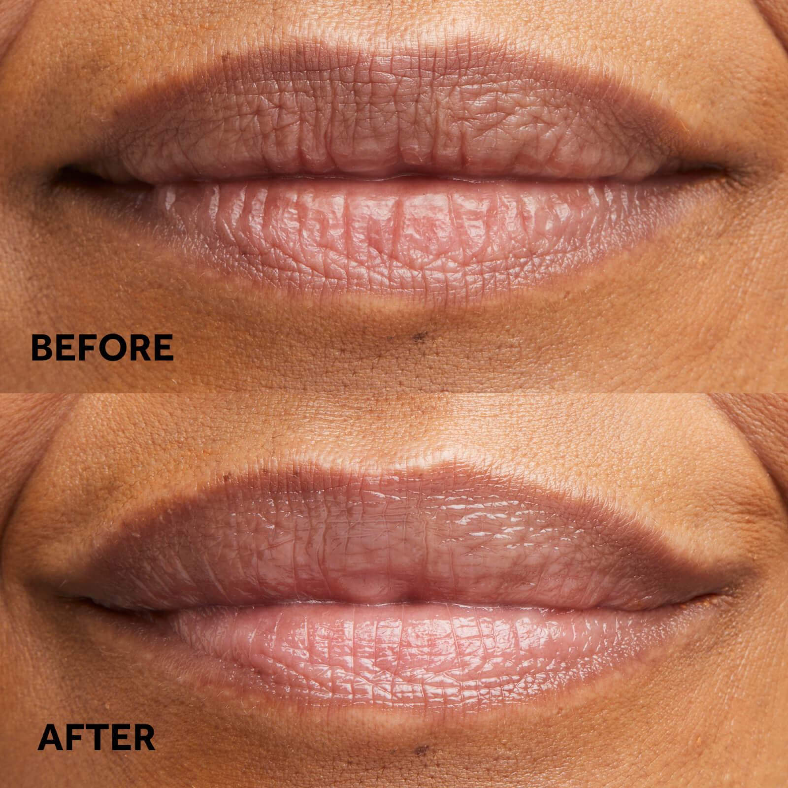 Before, After the lip treatment