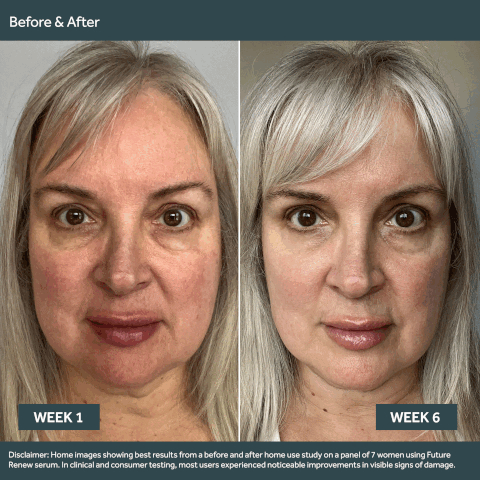 Before & After Week 1, Week 2 Disclaimer: Home images showing best results from a before and after home use study on a panel of 7 women using Future Renew serum. In clinical and consumer testing, most users experienced noticeable improvements in visible signs of damage. A world-first in peptide technology. Powered by pepticology, supporting skin's natural self-repair process