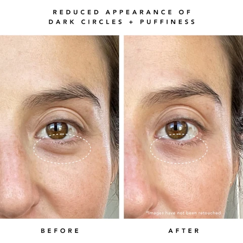 Reduce appearance of dark circles and puffiness. before and after *images have not been retouched