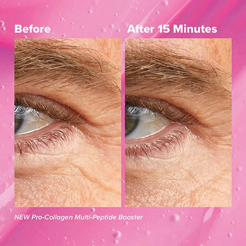 Image 1, before and after 15 minutes new pro-collagen multi peptide booster. Image 2 and 3, before and after 8 weeks, new pro collagen multi peptide booster.