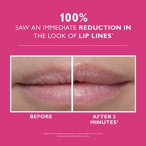 Image 1 - A before and after comparison of a persons lips on a pink background, showing the left image with visible lip lines labeled BEFORE, and the right image with fewer visible lip lines labeled AFTER 5 MINUTES, with the overarching text 100% SAW AN IMMEDIATE REDUCTION IN THE LOOK OF LIP LINES*, and footnotes *Based on a 4-hour clinically measured study on 15 women, ranging in age from 21 to 54. †Unretouched photos. Individual results may vary. Image 2 - The image shows three pairs of before and after close-up photos of different peoples lips, demonstrating increased plumpness and glossiness after 5 minutes, with visible text Before, After 5 Minutes*, and *Unretouched photos. Individual results may vary. Image 3 - A swirled dab of light pink, shimmery cream is shown on a white background with callouts reading Moisturizing cream-to-balm formula, Invisible sheer finish, and Plumping peptide complex. Image 4 - Two women display different lip looks: one with plumped, pale pink glossy lips, and the other with plumped, bright red glossy lips, with text reading 2 WAYS TO PLUMP WITH Instant FIRMX® Lip Filler, Lip Treatment Wear alone during the day or night to moisturize and smooth, and Lip Primer Wear under lipstick to prolong and enhance your color. Image 5 - A silver and pink tube of Peter Thomas Roth Instant FirmX Lip Filler plumping peptide complex, 10 ml / 0.3 fl oz, stands on a background of swirling pink cream, next to large black text that says CLINICALLY PROVEN to immediately improve the look of lip plumpness and lip lines*, with a smaller disclaimer at the bottom reading *Based on a 4-hour clinically measured study on 15 women, ranging in age from 21 to 54. Image 6 - A white and pink tube of Peter Thomas Roth lip filler is shown with its cap off on a pink background, displaying the text PETERTHOMASROTH CLINICAL SKIN CARE INSTANT FIRMX LIP FILLER plumping peptide complex 10 ml / 0.3 fl oz, and callouts for 2% LINEFILL Instantly increases the look of lip fullness for a temporary effect, 3% HYALURONIC ACID FILLING SPHERES Plump the look of lips with moisture, and 1% MAXI-LIP Helps enhance the look of lip volume with continued use. Image 7 - A split image shows a person with fair skin applying a lip product labeled PETERTWOM to their glossy lips, and a person with dark skin touching their glossy lips, with text overlays that read Apply to clean, dry lips and Plumps the look of lips in 5 minutes or less!