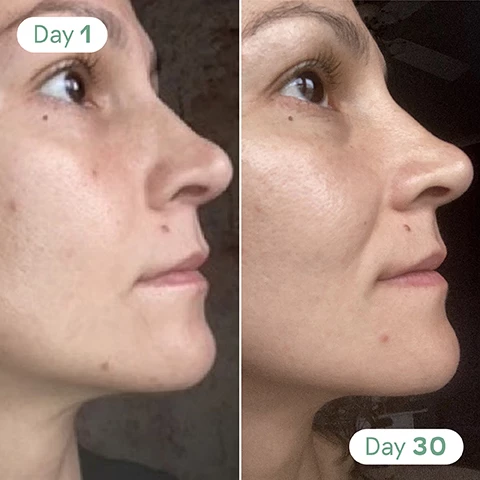 Image 1, day 1 vs day 30. Image 2, balances stressed skin, firms, brightens, targets breakouts. Image 3, 81% said skin felt brighter* *beauty panel of 79 women over 30 days.