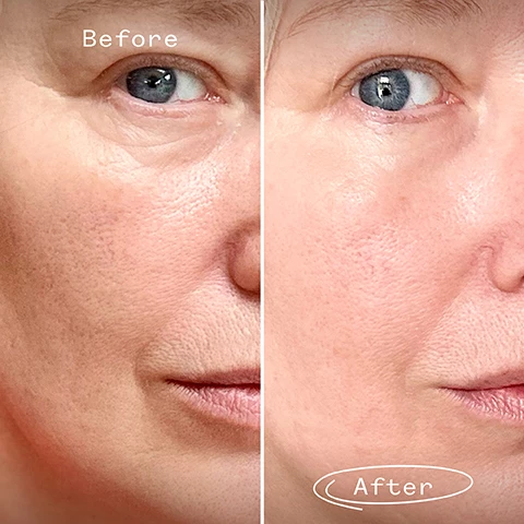 Image 1, before and after. image 2, retinal - improves visible signs of ageing. reduces appearance of fine lines. improves skin tone and elasticity. image 3, retinal - gentle on sensitive skin, fast results, 100% natural. retinol - irritates sensitive skin, slower results, usually synthetic. image 4, retinal - a 100% natural retinoid from pink salt lakes to improve the signs of ageing.