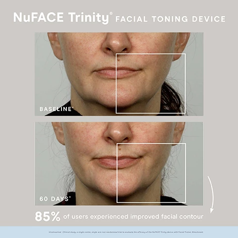 Image 1, NuFace trinity facial toning device base line and after 60 days. 85% of users experienced improved facial contour. Image 2. nu face trinity facial toning device, improve facial contour, tone and appearance of fine lines and wrinkles, 5 minute faical lift, 5 minutes a day, 5 days a week, interchangeable attachments for personalized routine, FDA-cleared aesthetician approved. Image 3, step 1 = cleanse, use an oil free cleanser like our prep n glow facial towelettes. step 2 = boost, apply a few drops of one or both of our lenized super booster serums onto fingertips and massage into clean, dry skin until fully absorbed. step 3 = active plus lift, apply a mask like layer of one of our microcurrent activators in sections as you lift. perform glides/holds usuing the trinity or mini device. Image 4, nu face real results, before and after - uplifted jaw. Image 5, trinity, pro level targeted treatments and mini, on the go treatments. what they do = tones, lifts and contours face and neck, reduced appearance of fine lines and wrinkles, delivers the microcurrent down to the muscle. treatment lengths = 5-15 minutes. trinity treatment areas = neck and jowls, cheeks, forehead, eyes and lips and nasolabial folds (with attachment), mini on the go treatment areas = neck and jowls, cheeks and forehead. trinity comes with effective lip and eye attachment and trinity wrinkle reducer attachment.