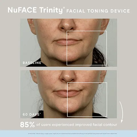 Image 1, NuFACE Trinity' FACIAL TONING DEVICE BASELINE 60 DAYS' 85% of users experienced improved facial contour Image 2, NuFACE Trinity® Facial Toning Device Improve facial contour, tone and appearance of fine lines and wrinkles 5-Minute Facial-Lift 5 minutes a day, 5 days a week Interchangeable attachments for personalized routine FDA-Cleared, Aesthetician Approved Image 3, STEP 1 CLEANSE Use an oil-free cleanser, like our Prep-N-Glow® Facial Towelettes. FACIA TOWELETT NOFACE NOFACE BOOSTER SUPER PEPTID BOOSTER STEP 2 BOOST Apply a few drops of one or both of our lonized Super Booster serums onto fingertips and massage into clean, dry skin until fully absorbed. STEP 3 NOFACE ACTIVATE = = + LIFT Apply a mask-like layer of one of our Microcurrent Activators in sections as you lift. Perform glides/holds using the Trinity" or Mini Device. Image 4, NUFACE REAL RESULTS BEFORE LIFTED BROW LIFTED JAW AFTER
