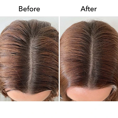 Image 1 - Image showing a comparison of hair before and after treatment, with the left side labeled Before displaying dull and unkempt hair, and the right side labeled After showing smooth and shiny hair.
              Image 2 - A green container of Bumble and Bumble Seaweed Whipped Scalp Scrub is displayed, featuring text about its nutrient-rich ingredients and indicating it provides 2X shine instantly compared to unwashed hair.
              Image 3 - Image features a light green background with text highlighting a seaweed collection that includes ingredients such as royal sugar kelp, pacific sea kelp, and green microalgae, along with icons indicating 93% naturally derived ingredients, vegan status, and 100% recycled packaging.
              Image 4 - A green jar of Bumble and bumble Bb. Seaweed Whipped Scalp Scrub is shown against a light green background, with icons and text indicating benefits like scalp care, adds shine, gentle, deep-cleansing, and free of sulfate cleansers, along with the text infused with a trio of nutrient-rich seaweeds.