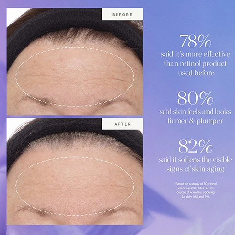 Image 1, before and after. 78% said it's more effective than retinol product used before. 80% said skin feels and looks firmer and plumper. 82% said it softens the visible signs of skin aging. based on a study of 50 retinol users aged 25-65 over the course of 4 weeks, applying twice daily AM and PM. image 2, acai plant stem cell. tighten, firm and smooth. image 3, keep your glow without the waste. how to recycle plant stem cell retinol, alternative serum. remove the plastic wiper guard from 30ml size and recycle separately. rinse out any remaining or excess product, recycle the glass bottle. remove the dropper and discard. recycle the glass pipette separatly