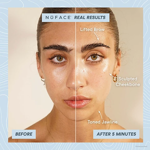 nu face real results, before and after 5 minutes. lifted brow, sculpted cheekbone, toned jawline.