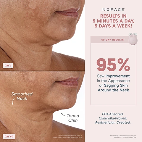 Image 1, results in 5 minutes a day, 5 days a week. day 1 vs day 60, toned chin and smoothed neck. 60 day results, 95% saw improvement in the appearance of sagging skin around the neck. FDA cleared, clinically proven, aesthetician created. results from a post consumer questionnaire after 60 days of use. image 2, 1 device, results anytime, anywhere. built in skin sensor = ensure consistent current intensity for all types of skin. petite and portable. energizing hum gentle vibration when device is turned on, 3 intensity levels. smart device technology perfect for on the go lifting. FDA cleared, clinically proven, aesthetician created. unlock exclusive treatments - bluetooth enabled, pair with the nuface smart app. image 3, smooth the neck, contour the cheeks, lift the brow. 1 device, results anytime, anywhere. image 4, before and after - lifted jaw and lifted hooded eyelid and brow. instant results in 5 minutes. immediate results, 90% saw a lifted appearance. FDA cleared, clinically proven, aesthetician created. results from a post consumer questionnaire after 60 days of use. image 5, day 1 vs day 60 - reduced deep lines. results in 5 minutes, 5 days a week. 60 say results. 93% saw reduction in the appearance of deep lines. FDA cleared, clinically proven, aesthetician created. results from a post consumer questionnaire after 60 days of use. image 6, lift brows, contour cheeks, contour jawline, tighten neck. image 7, microcurrent 101 = a low level electrical current that mimics and re-energises the bodys natural current to tone, lift and contour down to the muscles. skincare is your nutrition, micro current is your fitness. mini+ is fitness for your face. image 8, unlock app exclusive treatments to target different layers of skin and muscles. helps reduce wrinkles and plump skin - skin tightening mode. helps instantly lift and contour - instant lift mode. long term muscle sculpting - pro toning mode. image 9, smart app. follow step by step tutorials. track progress. customise results with app exclusive treatments. set treatment reminders. image 10, comparison of three nuface devices. trinity+ advanced customisation. unlock app exclusive treatments - yes. boost with 25% microcurrent - yes. nuface smart app - yes. attachment options (eye and lip attachment and LEF red light attachment sold separately - yes. microcurrent treatment areas - jowls and jawline, neck, cheeks and forehead, around eyes and brows, around mouth and lips, smile lines. mini+ on the go lifting. unlock app exclusive treatments - yes. boost with 25% microcurrent - no. nuface smart app - yes. attachment options (eye and lip attachment and LED red light attachment sold separately - no. microcurrent treatment areas - jowls and jawline, neck, cheeks and forehead. fix, instant finisher.