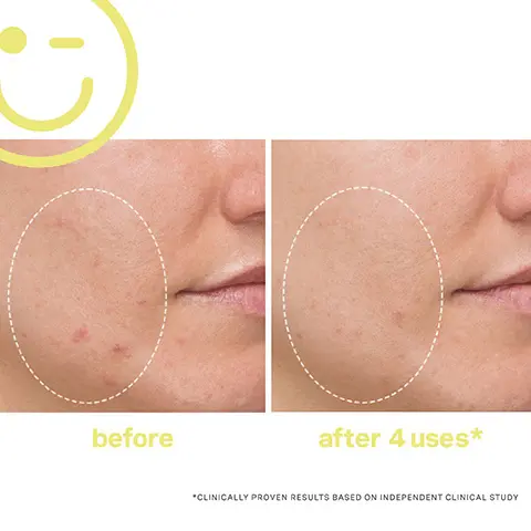 before vs. after 4 uses clinically proven results based on independent clinical study. 97% reported skin has a healthy glow after 2 uses. 88% reported skin looks brighter, more radiant with improved overall skin tone after 4 uses- clinically proven results based on independent clinical study.