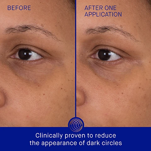 Image 3 - Side-by-side comparison of a persons eye area before and after one application of a product, with visible text that reads BEFORE on the left and AFTER ONE APPLICATION on the right, along with the text Clinically proven to reduce the appearance of dark circles at the bottom.
              Image 4 - A comparison image showing the left side labeled BEFORE and the right side labeled AFTER ONE APPLICATION, highlighting changes in skin texture and appearance, with visible text at the bottom stating Clinically proven to improve hydration and reduce the appearance of fine lines.
              Image 5 - An image showcasing two gold-colored eye patches on a dark background with text stating clinically proven results, including eye area appears over 2x more luminous, skin hydration is improved by 2.45x, and the appearance of fine lines and wrinkles is reduced by 71%.
              Image 6 - A woman with a smooth, radiant complexion is applying a golden under-eye mask while resting her hand on her cheek, accompanied by text that highlights user proven results: 98% agree under-eye bags and puffiness appear reduced, 93% agree the appearance of fine lines and wrinkles is reduced, and 93% agree the eye area looks more luminous, with a footnote about a consumer perception study.
              Image 7 - An orange gel eye patch is shown against a blurred blue background, with text describing its benefits: TFC8, A proprietary technology that creates the optimal environment for skin cellular renewal; Allantoin, Softens, soothes, and boosts radiance; Acetylated Hyaluronic Acid, Deeply hydrates and plumps under eye skin; Fermented Polysaccharide, Brightens and helps reduce appearance of fine lines and wrinkles.
              Image 8 - Image shows a step-by-step guide for using eye patches, featuring three steps with accompanying visuals: Step 1 shows a package of eye patches, Step 2 depicts a person applying an eye patch under their eye, and Step 3 displays the used eye patches; visible text includes Step 1 Apply The Eye Patches under the eye area on clean, dry skin, Step 2 Leave The Eye Patches on for 20 minutes, Step 3 Remove and follow with your Augustinus Bader skincare routine, and AB Insider Tip Put The Eye Patches in the fridge before use for an extra cooling and de-puffing effect.
              Image 9 - An image displaying a skincare routine with four steps titled The Routine for Deeply Hydrated Skin, including products for cleansing, eye patches, a serum, and options for hydration with specific product names listed.