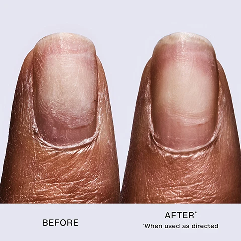 Image 1 - Image shows two close-up views of a fingernail; the left side labeled BEFORE shows a damaged nail, and the right side labeled AFTER* displays a healthier nail appearance with a note stating *When used as directed.
              Image 2 - A bottle of O.P.I Repair Mode nail serum stands on a bright green surface, with a white applicator sticking out, alongside droplets of water, featuring visible text that reads 99% Nail Keratin Repair*.
              Image 3 - A close-up of a hand with dark skin applying a clear product to a bare, manicured nail, featuring text that reads First Ever Patented Ulti-Plex Technology™ and Vegan Formula*.