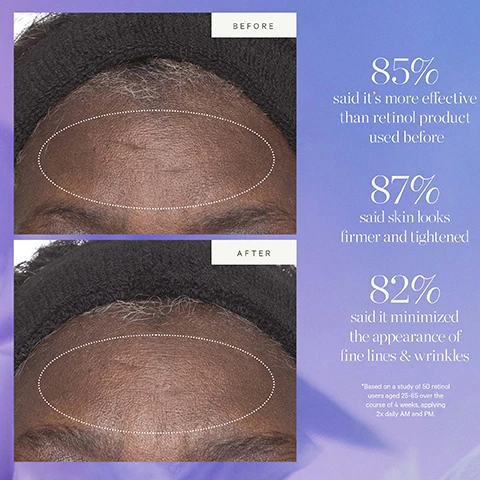 Image 1, before and after. 85% said it's more effective than retinol product used before. 87% said skin looks firmer and tightened. 82% said it minimized the appearance of fine lines and wrinkles. based on a study of 50 retinol users aged 25-65 over the course of 4 weeks, applying twice daily AM and PM. image 2, acai plant stem cell, tighten, firm and smooth. image 3, keep your glow without the waste, how to recycle plant stem cell retinol alternative moisturiser. remove empty pod, rinse out any remaining or excess product, recycle the pod. place new refill pod into glass jar.