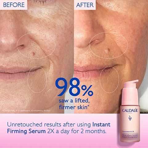 Image 1, before and after, 98% saw lifted firmer skin. unretouched results after using instant firming serum 2 times a day for 2 months. image 2, 98% saw a lifted firmer skin. image 3, 3 times more effective than retinol to firm and lift. image 4, vegan collagen 1 - lifting effect. hyaluronic acids - smooth and hydrate. collagen booster - firm skin. resveratrol - anti wrinkles. image 5, which serum for your skin? premier cry - global anti-aging. resveratrol lift - wrinkles and firmness. vinoperfect - radiance and dark spots. image 6, how to recycle instant firming serum. 1 = recycle the glass bottle in the recycling bin, 2 = recycle the pump with terracycle. image 7, new resveratrol lift firming serum. 98% saw a lifted firmer skin. 3 times more effective than retinol. new formula with vegan collagen