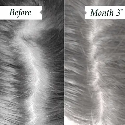 Before and month 3. 92% reported scalp felt stimulated. 92% reported scalp felt healthy- independent user trial. 90% reported scalp felt healthier. 84% agreed scalp felt energised- independent user trial.