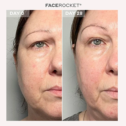 Image 1 - Image shows a side-by-side comparison of a womans face labeled DAY 0 on the left and DAY 28 on the right, highlighting changes in her skin appearance over 28 days.
              Image 2 - Side-by-side comparison of a womans face showing results after 28 days of using the FACE ROCKET product, with the left image labeled DAY 0 and the right image labeled DAY 28.
              Image 3 - Image shows a side-by-side comparison of a womans face labeled DAY 0 on the left and DAY 28 on the right, with visible differences in skin clarity and appearance.
              Image 4 - A side-by-side comparison of a womans profile on the left labeled DAY 0, showing her face with visible redness, and on the right labeled DAY 28, displaying a smoother appearance with less redness.
              Image 5 - A person holding a gray handheld device with a red light at the top and buttons labeled FIRM, TONE, and COOL, with text alongside detailing skin care benefits like stimulate collagen production and improve lymphatic drainage.
              Image 6 - A smiling woman with gray hair holds a facial beauty device in her right hand, with text nearby stating that in a survey of 32 women using the Magnitone FaceRocket with Superconductive Gel for 14 days, 94% agreed they were satisfied with the lifting and tightening effect on their facial skin, 88% agreed they were satisfied with the effect of tightening fine lines around the eyes, and 94% agreed they were satisfied with the immediate calming plus soothing effect on their skin.
              Image 7 - A woman with blonde hair and a light shirt smiles while holding a skincare device, with text on the left listing features such as clinically shown results, five technologies, three easy to use modes, step-by-step 28-day face program, and additional product details.
              Image 8 - Infographic describing various skin treatment methods with icons and text labeling each method: Radiofrequency, Microcurrent, Red + Green LED Light Therapy, Cryotherapy, and Sonic Massage, detailing their benefits for skin.
              Image 9 - A person with braided hair is holding a skincare device next to their face, which has visible cream on it, with various award logos including Highly Commended, Winner, and Menopause Friendly displayed around the image, along with the text FIRM, TONE, and COOL on the device.