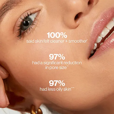 Image 1, 100% said skin felt cleaner + smoother* 97% had a significant reduction in pore size 97% ** had less oily skin **A. Image 2, Before and After