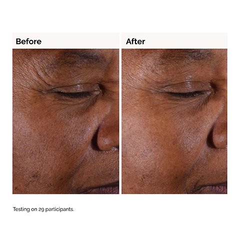 Image 1, before and after. testing on 29 participants. image 2, testing for glycolic acid shows: exfoliates ski for a smoother appearance. skin looks more even-toned and radiant. reduces look of fine lines and wrinkles. improves scalp hydration. image 3, prep - glycolic acid 7% exfoliating toner = exfoliation, radiance and radiance and uneven tone. treat - hyaluronic acid 2% + B5 = hydration, elasticity, plumping. image 4, helps balance uneven skin tone and correct texture over time. 7% glycolic acid tasmanian pepperberry. water based solution. image 5, apply after cleansing. sweep a saturated cotton pad across the entire face. image 6, prep = cleansers and toners. treat = water based serums, eye serums, anhydrous solutions, oils. seal = suspensions, moisturisers, SPF.