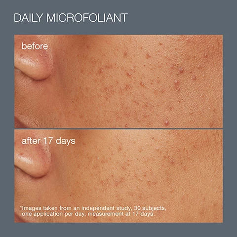 image 1, daily microfoliant before and after 17 days. images taken from an independent study, 30 subjects, 1 application per day, measurement at 17 days. image 2, 3 full sized best sellers.